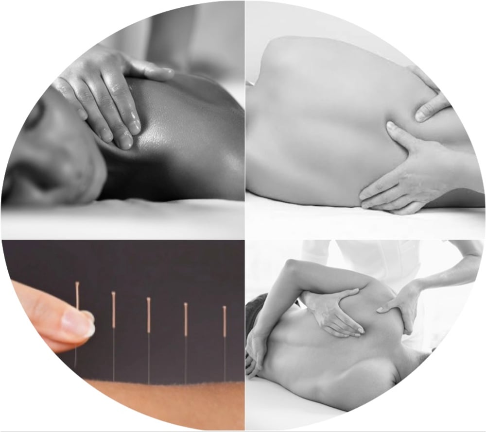 Sydney Remedial Massage  Dry Needling and Electro-Dry Needling - What Is  the Difference? - Sydney Remedial Massage