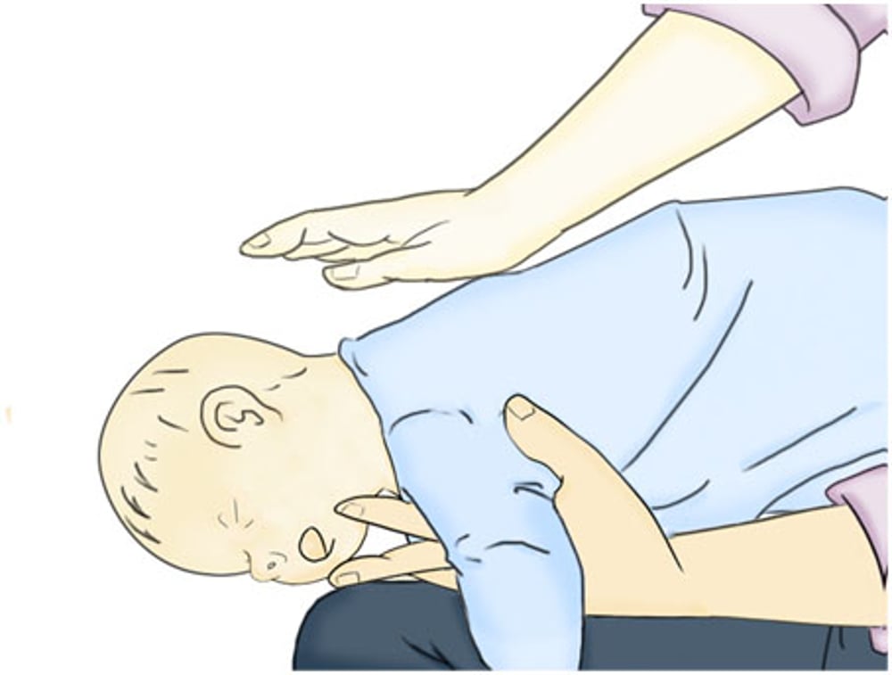 O que fazer quando o bebê engasgar - Bombeiro Amigo do Peito