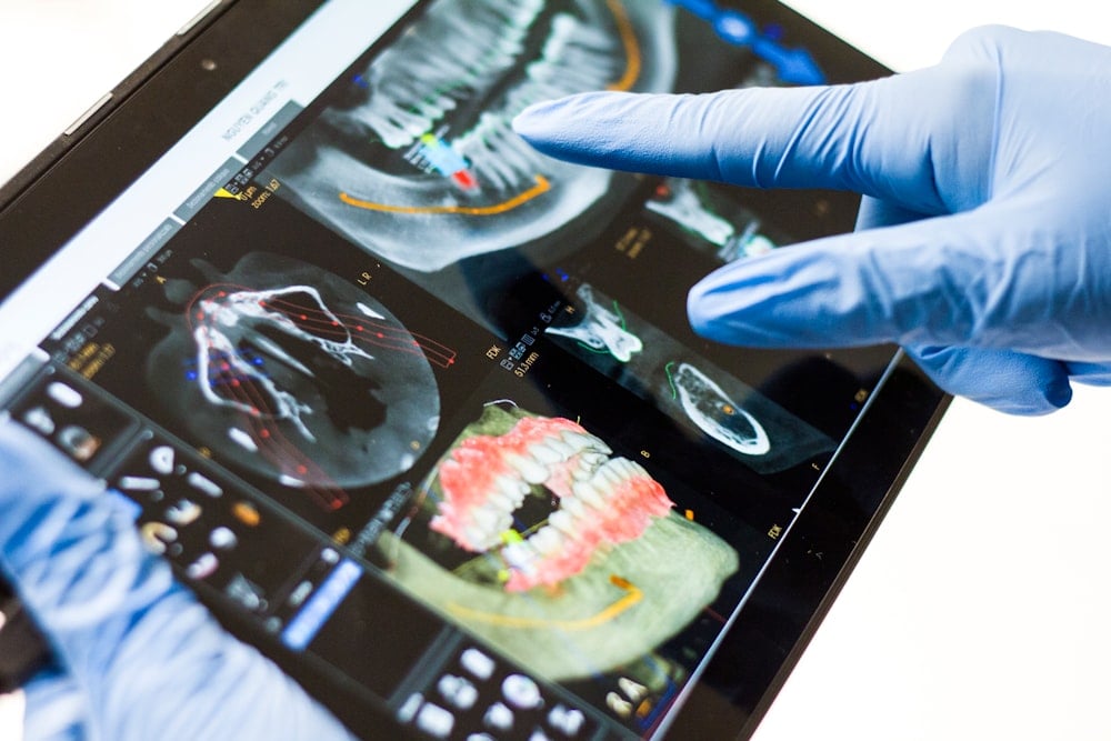 Smart View Pad for Digital Dentist - The New Way To Communicate With The Patient.